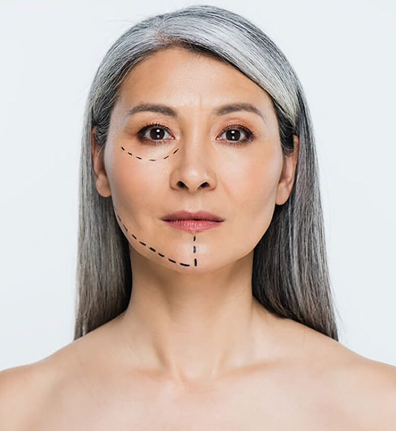 mujer rostro marcado